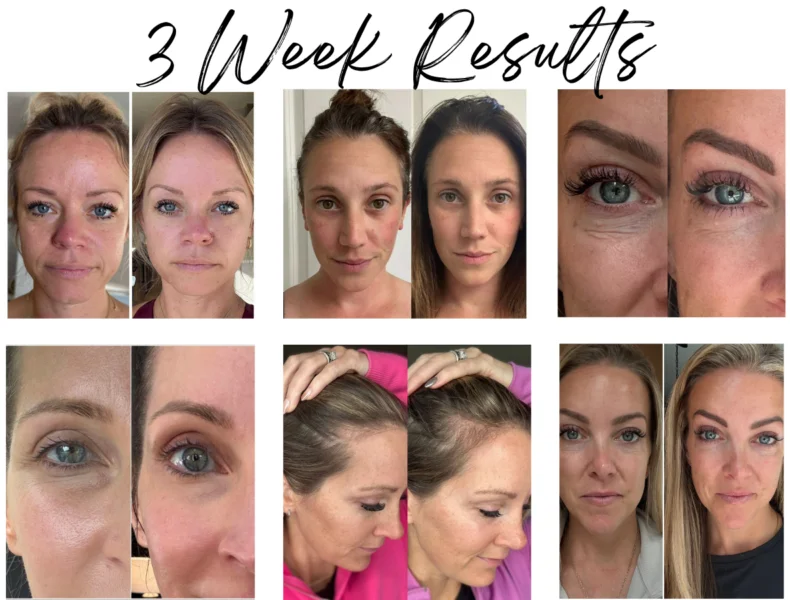 Beneve Luxe peptide before and after 3 week results skin appearance comparison